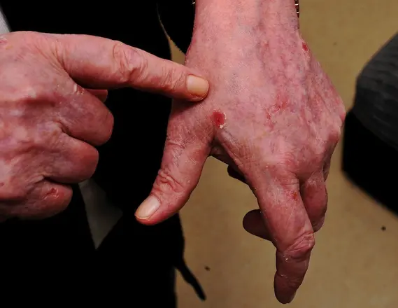 It’s not “if,” but “what” protection should be worn